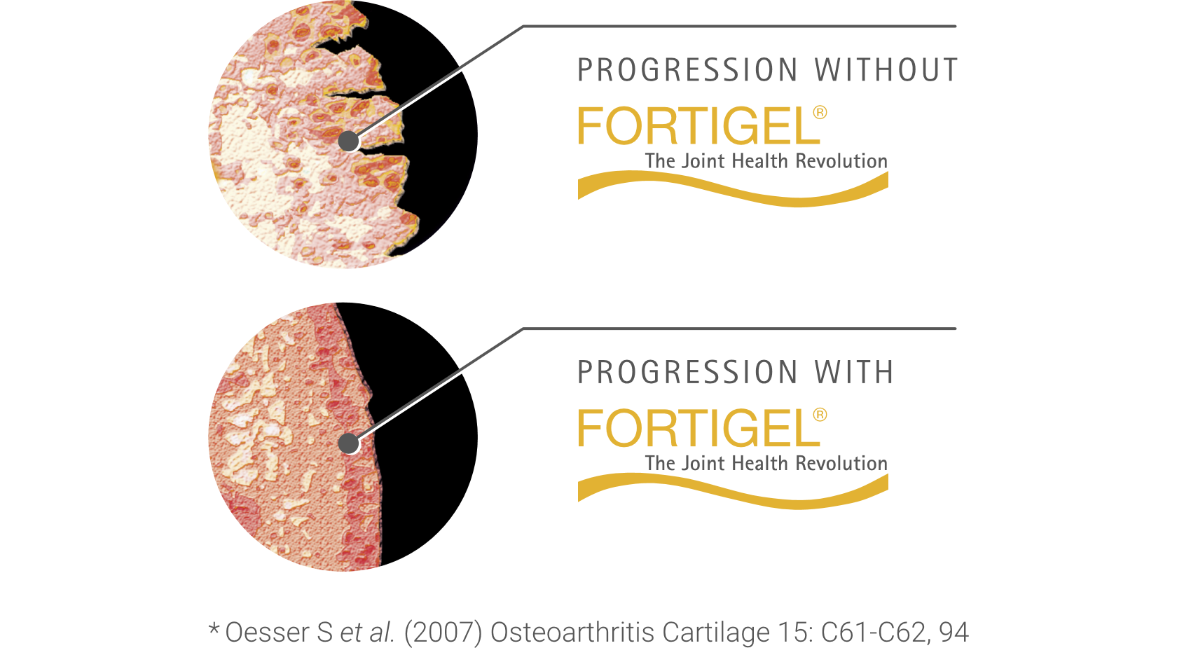 fortigel