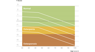 Colágeno FORTIBONE - Medição da Densidade Mineral Óssea