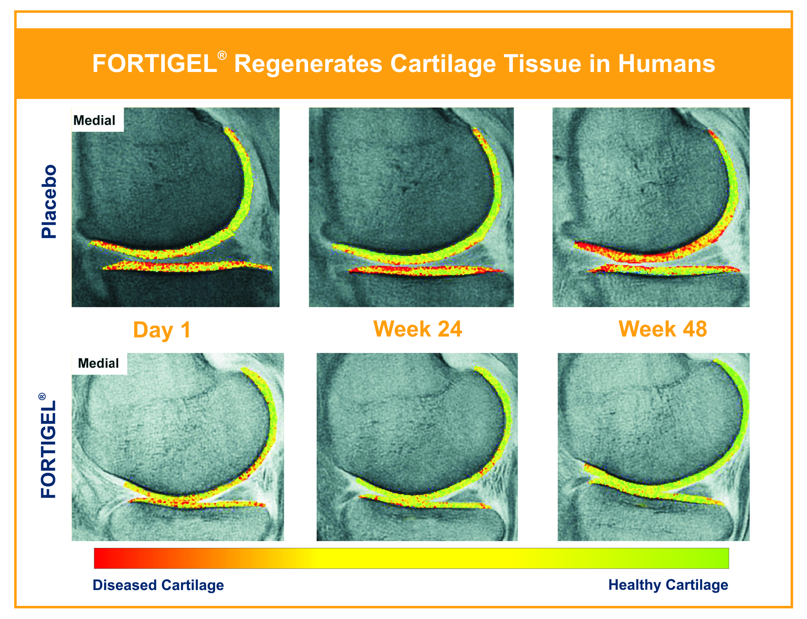 FORTIGEL