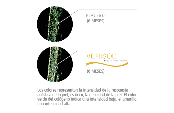 densidad de la dermis