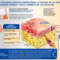 VERISOL combate de las celulitis